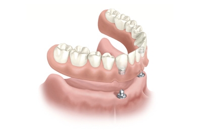 http://members.itellico.com/12809/13311-dent4youat/pictures/file_1238343298-521376ae87414b7c217274d4fc4037be.jpg